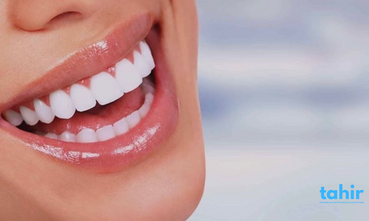 How to Get a Whiter Smile: Teeth Whitening Tips That Work